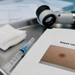 Que recherche t on dans une biopsie de la peau : instruments de biopsie cutanée